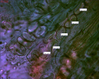600 keer vergroot, in Melzer's reagens. Opvallend is de fijne granulering van de sporen, die ook duidelijk wordt weergegegevn in Breitenbach und Kranzlin, Pilze de Schweiz 1