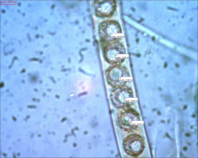 600 keer vergroot. Lamprospora heeft ronde sporen met typische ornamentatie.