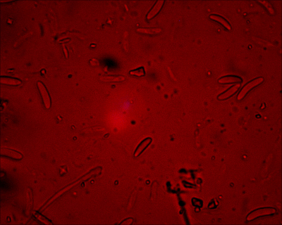 op een abelentak vond ik zwarte schijfzwammetjes, die met de miccroscoop eenvoudig op naam te brengen waren. Sporen iets gekromd, ong. 10 micrometer