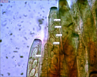 Onder de Bresser microscoop. De sporen zijn wat kleiner dan opgegeven door Breitenbach und Kranzlin, maar ze zijn nog niet helemaal rijp, de ascus is nog geheel gesloten. Duidelijk te zien is de typische blauw verkleuriujg van de ascustop in Melzers reagens.