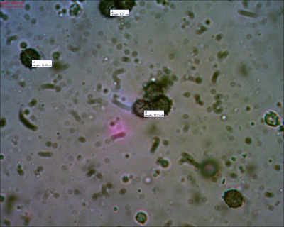 Sporen met de Bresser microscoop, ze zijn groter dan die van de er op gelijkende melkzwammenn en hebben lagere kammen