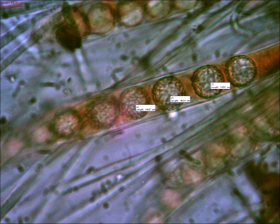 Ook dit is een mosschijfje van Benaliri, maar hoewl die er macroscopisch gezien er anders uitzag is ie microscopisch vrijwel hetzelfde. Dit is Benaliri2