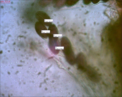 600 keer versgroot. De sporen van Ascobolus zijn in veel gevallen zwart, met een anastomoserende streping. De streping is helaas op de foto niet (goed) te zien, maar is er wel.