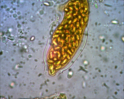 Een sporangium van het gele ding van Thgeo in et det. album. Wie het weet mag het zeggen.