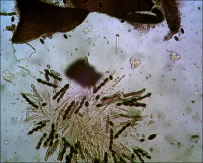 Met de Bresser microscoop, 100 keer vergroot. Het inbewdmedium is Melzers reagens, dat gebruik ik altijd omdat de zetmeelreactie van de asci, sporen of parafysen een belangijk kenmerk is. Opmerkelijk is dat deze soort 4 sporen per ascus heeft, meestal zijn het er 8 (of meer bij dit soort kleintjes)